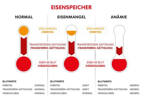 Grafik Eisenmangel